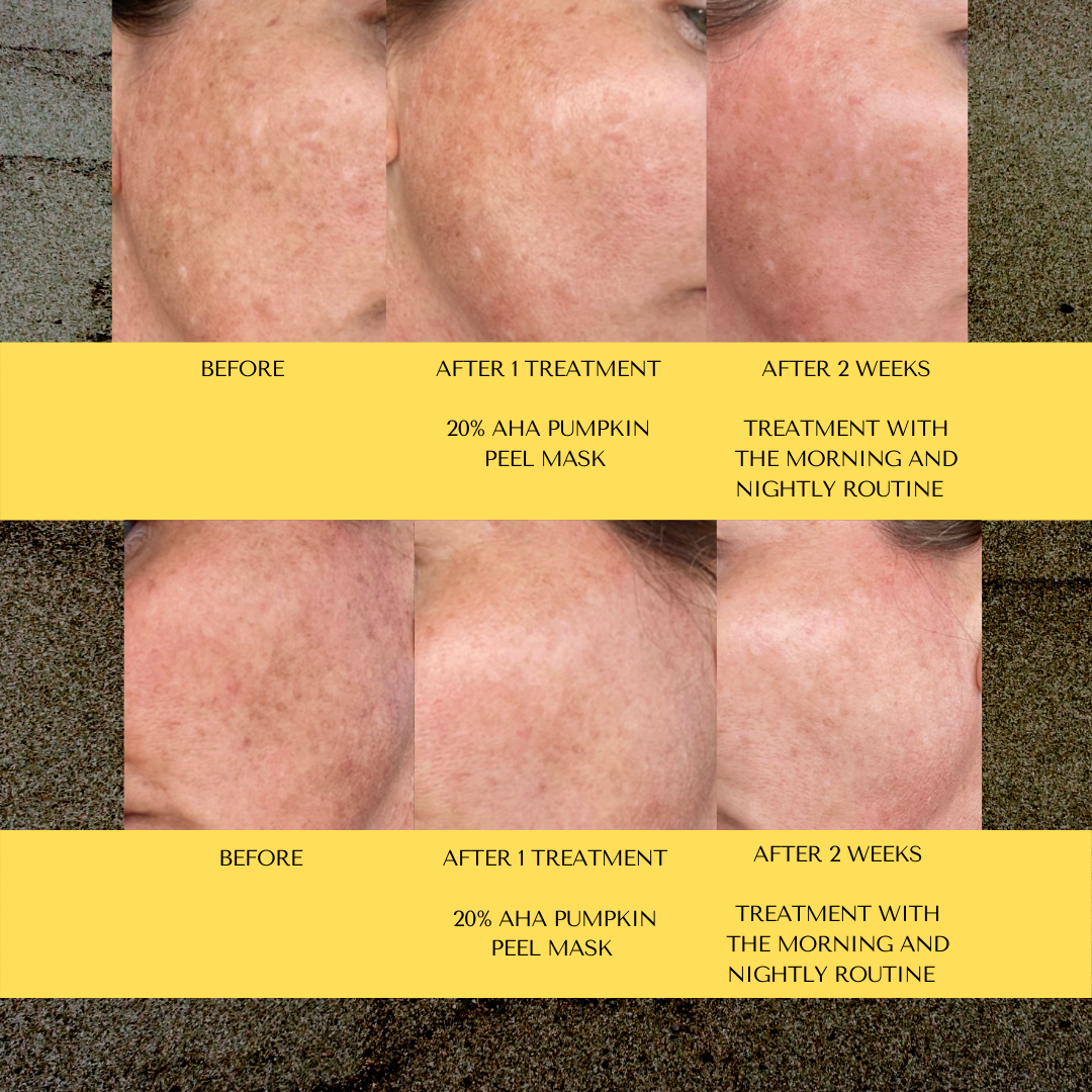 SPF 30 Vitamin C Moisturizer